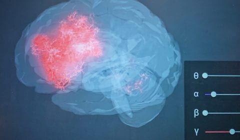 Brain scan 3. Photo by Mark Pegrum, 2019.